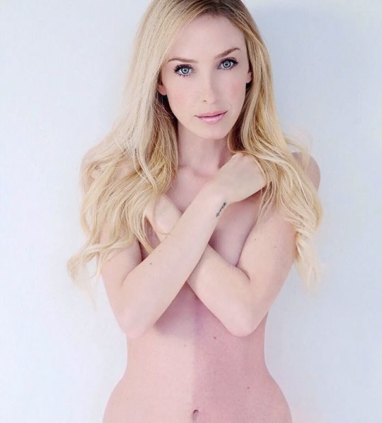 На этих фото показали, какие финты генетика вытворяет с людьми