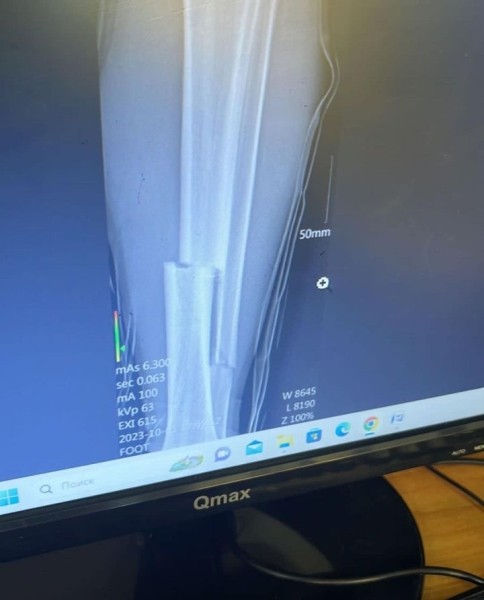 Вратарь сборной Беларуси по футболу получил страшную травму Вратарь сборной Беларуси по футболу получил страшную травму